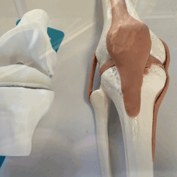 Knee prosthesis model