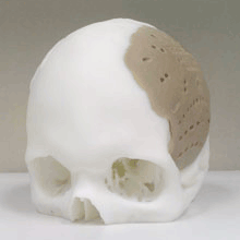 Skull cast